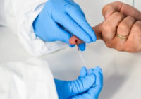 उज्जैन:निजी लैब में हो रहे रैपिड एंटी बॉडी टेस्ट को लोग समझ रहे है कोरोना टेस्ट