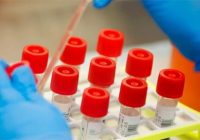 उज्जैन:कोरोना के नए स्वरूप को लेकर अभी उज्जैन जिला सेफ : डॉ. एचपी सोनानिया