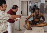 उज्जैन में पारिवारिक विवाद के चलते अधेड़ ने खुद को लगाई आग, 80% झुलसा; इंदौर रेफर