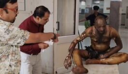 उज्जैन में पारिवारिक विवाद के चलते अधेड़ ने खुद को लगाई आग, 80% झुलसा; इंदौर रेफर